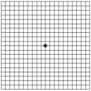 test di amsler ferrara